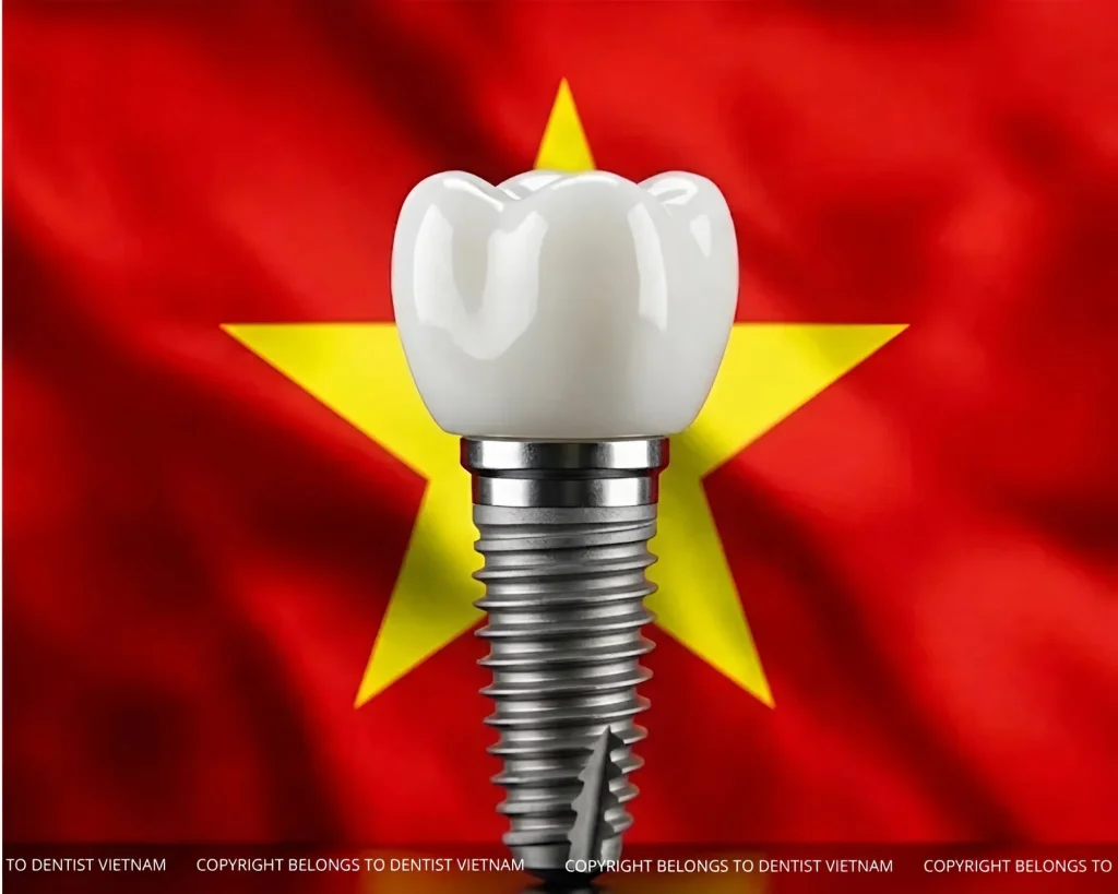 cheap dental implants