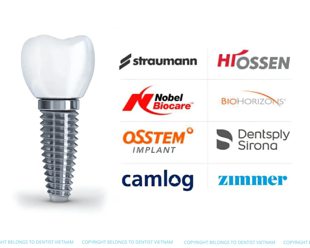 permanent full dental implants cost
