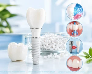 Your 2026 guide to dental tourism Vietnam – Treatment and costs